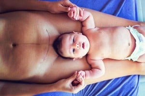 A baby lies on an adult's chest, holding their hands. The adult has a visible surgical scar down the center of their chest, likely from a c-section. They both appear to be lying on a blue surface, and the baby is wearing only a diaper. The image captures a tender bonding moment.