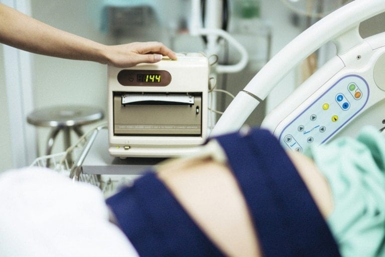 A medical professional adjusts a fetal monitor displaying a heart rate of 144 during an NST pregnancy. The patient, partially visible in the foreground, is lying on a hospital bed with monitoring equipment attached. The setting is a hospital room.