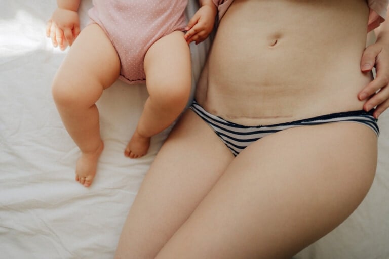 A close-up photo showing the lower bodies of a baby wearing a light pink onesie and an adult, whose c-section scar is visible above striped underwear, lying next to each other on a white fabric surface.