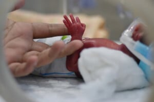 A micro preemie in an incubator holds onto an adult's finger. The tiny baby, wearing a diaper and connected to medical tubes, grips tightly as the adult's hand gently touches their small hand.