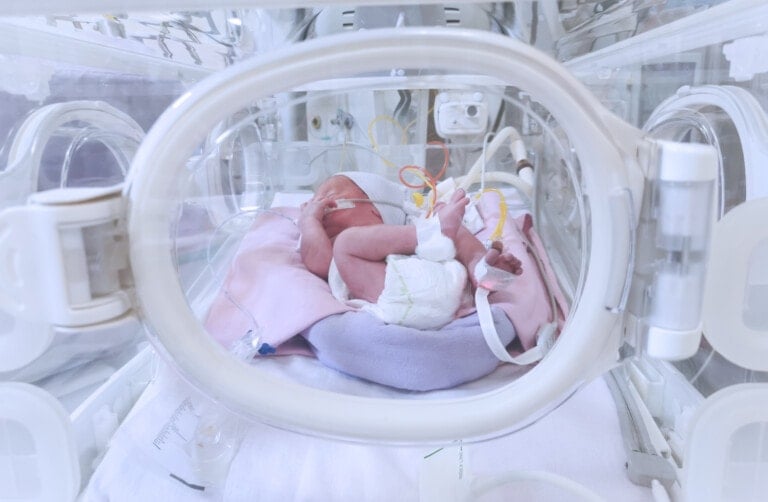 A newborn baby lies in an incubator surrounded by medical equipment. The baby, wearing a diaper, has several wires and tubes attached, indicative of medical monitoring and support. The scene is characteristic of NICU babies in a clinical setting, suggesting a hospital neonatal unit.