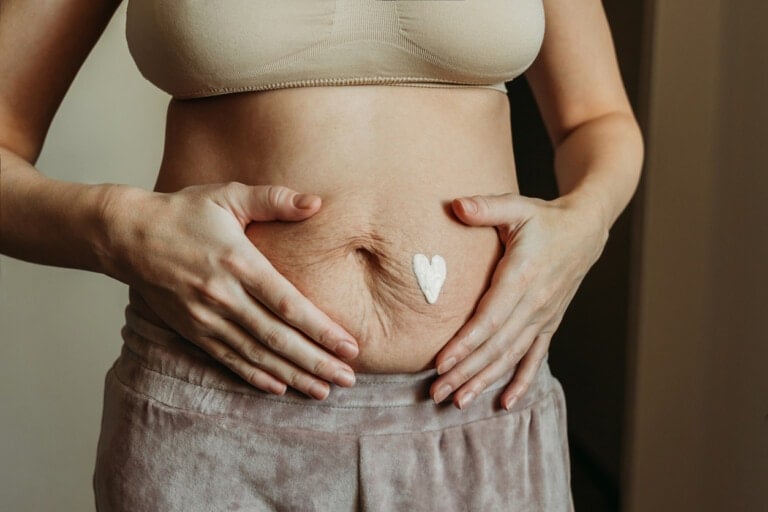 A person wearing a beige bra and grey pants applies heart-shaped cream to the stretch marks on their pregnant belly. Their hands rest gently on either side of the abdomen, highlighting the midsection and preparing care for the post-pregnancy tummy.